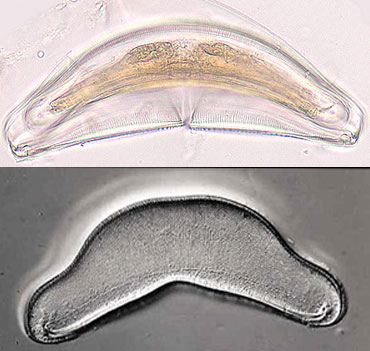 Amphorotia sp. Extinct Diatom